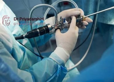 Hysteroscopy in Delhi